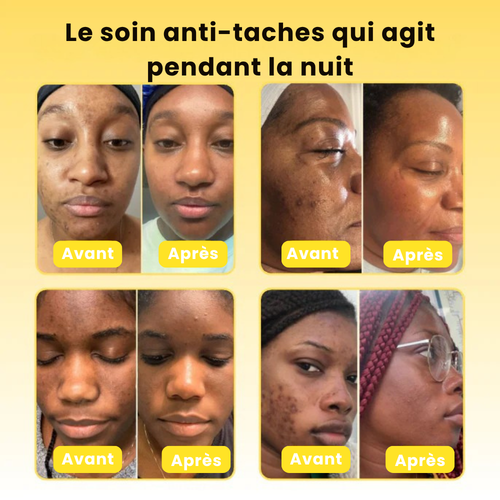 Masque de nuit - Efface les tâches brunes & Unifie le teint